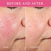Rose Facial Serum